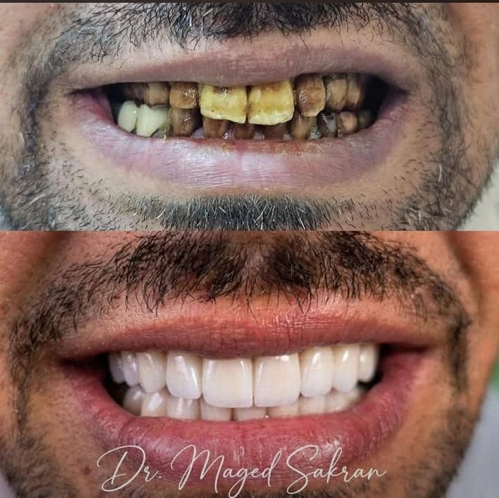 صنعاعة الابتسامة